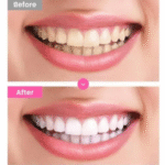 Euthymol – Original Toothpaste Whitening 106g - Imagem 3