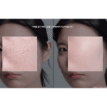 Medicube Toner Pads Zero Poros 2.0 -70Pads-155g - Imagem 4