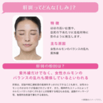 Transino EX – Medicamento para Melasma - Imagem 3