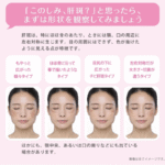 Transino EX – Medicamento para Melasma - Imagem 4